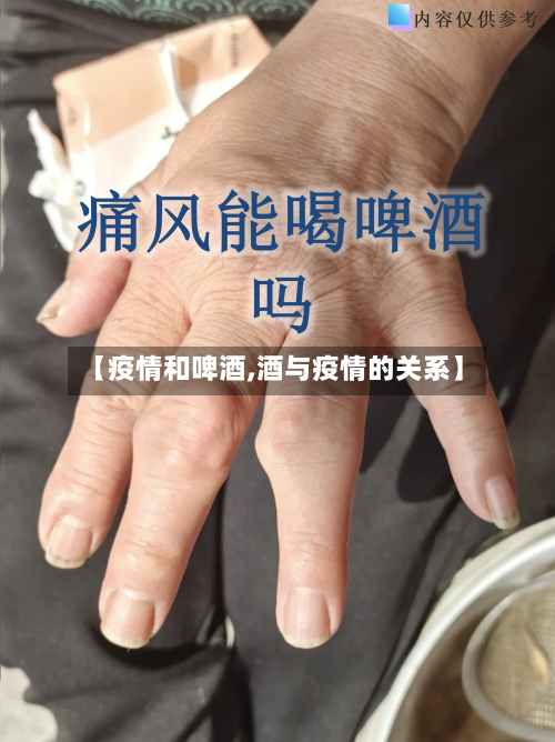 【疫情和啤酒,酒与疫情的关系】-第1张图片